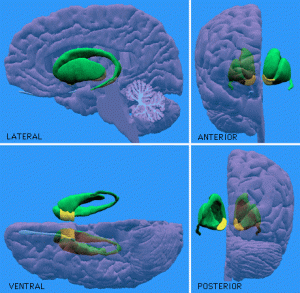 Accumbens Caudate Putamen