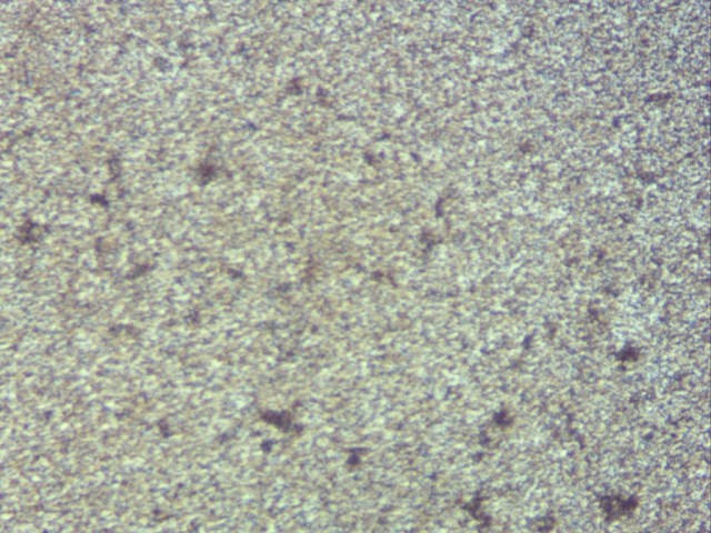 Campione di controllo